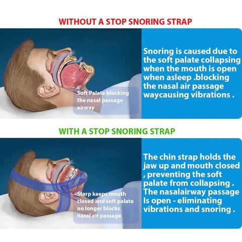 Anti Snore Chin Strap for Snoring Solution