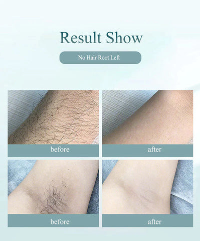 IPL Hair Removal for Women Men, Hair Remove Whole Body Use